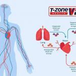 T-Zone Whole Body Vibration Machine Improved Blood Circulation, An Excellent Benefit of Vibration Machine